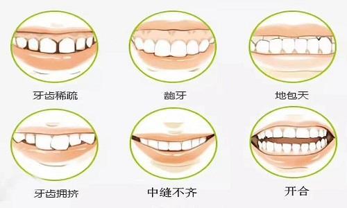 做个决定之前，先听听牙医的分析，告别牙痛烦恼