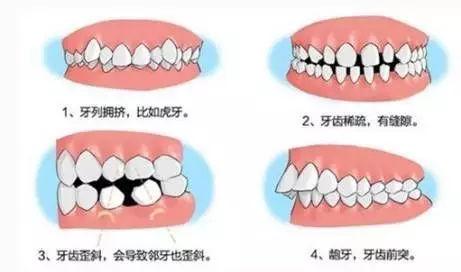 石家庄省二院正畸价目表，公立牙科推荐！