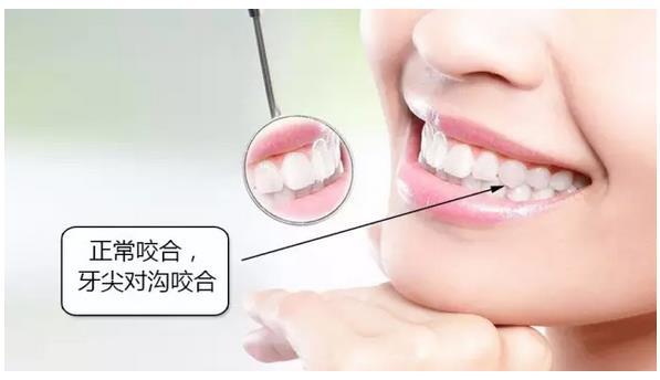 日照市上牙龈突出排名榜前十佳揭晓-日照市上牙龈突出口腔医生