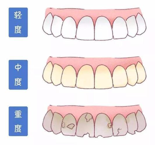 来看！贵州人民医院牙科收费标准公布