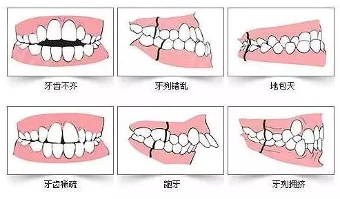 南京润玺口腔种植和牙齿矫正真的值得信赖？内幕爆料！