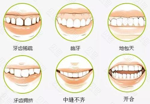 【更新】扬州口腔医院价目表新版问世，真人牙齿矫正案例参考
