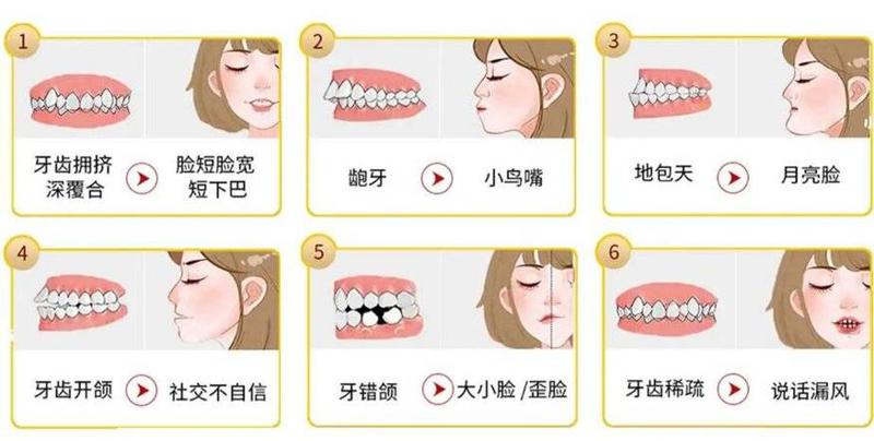 北京金圣口腔怎么样？附龅牙牙齿矫正案例分享和牙齿整形价目表
