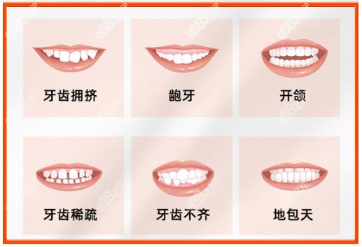 牙齿矫正费用一般是多少？有哪几种方法？