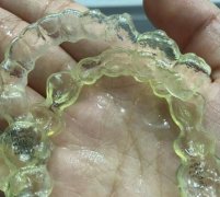 泗洪曹殿春口腔价格表2025优惠发布！牙齿矫正案例分享！
