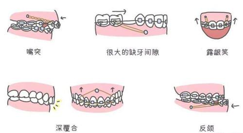 张江口腔医院地址在哪里：上海市浦东张江高科技园区张衡路528号