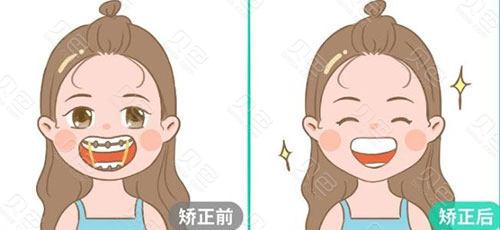 汉寿县植德口腔：高效牙齿矫正，当天免费拍片！快来了解吧！