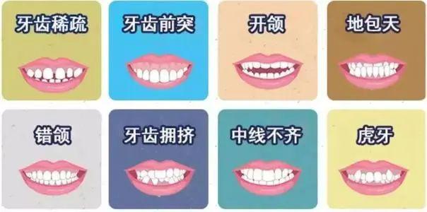 柳州牙齿矫正价目表，3D牙齿矫正技术案例
