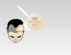 重庆迪邦皮肤医院植发科睫毛种植需要多少钱  术后多久恢复