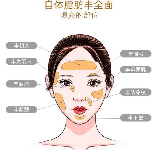 自体脂肪填充手术价格表：解析价格表，了解各项收费详情
