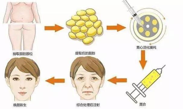 衡水提臀手术整形的价格便宜效果明不明显