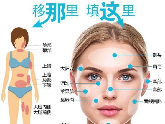 自体脂肪填充丰胸价格是多少？与价格相关的因素有哪些？