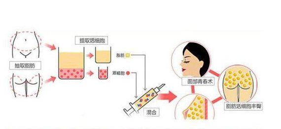 [评测]十堰太和医院美容科怎么样？项目价格曝光、附医生介绍