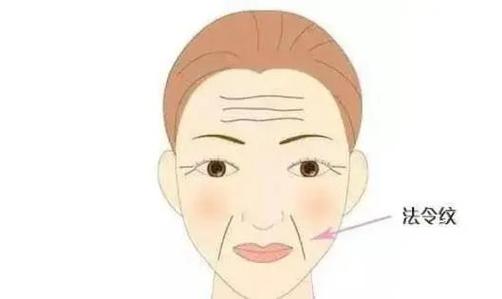 做自体脂肪填充面颊后，会不会出现凹凸不平？