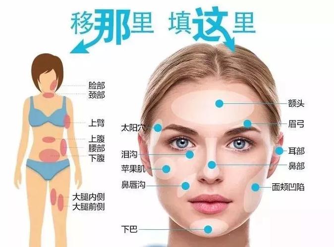 自体脂肪填充手术费用解析：价格范围及影响因素一览