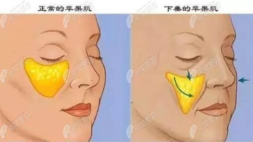 福州隆美尔整形美容医院价目表发布，费用明细一览，价格是否合理一看便知