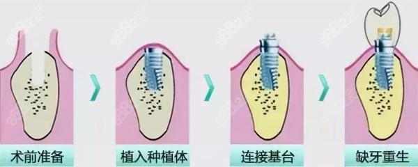 许昌口腔医院收费标准2025新价目表发布，医院医生+案例欣赏！