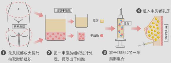 郑州曼蒂整形美容医院怎么样，实力领先医院推荐