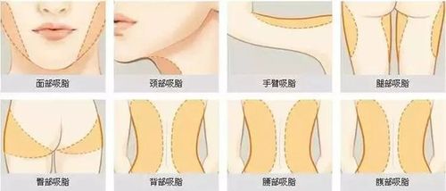 深圳柏悦整形医院价目表一览，附医生团队及案例效果图~