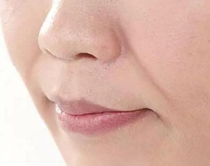 自体脂肪丰太阳穴手术价格表，价格贵吗？了解手术效果与恢复时间
