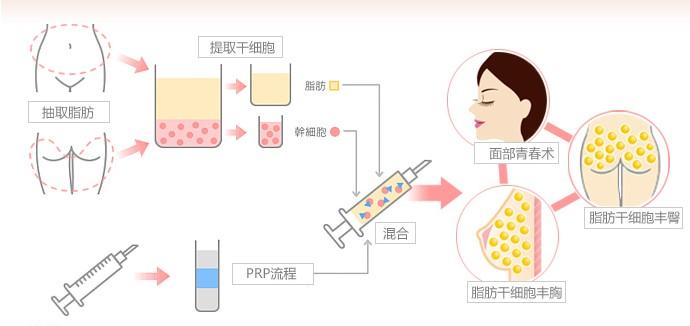 m唇整形手术费用解析：价格表一览，了解不同材料及医院对价格的影响