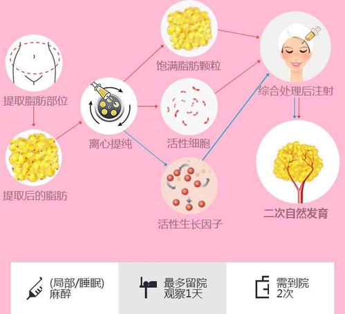 郭震宇医生自体脂肪丰胸手术价格表，价格实惠高效，价目表公开透明