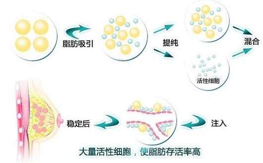 南充韩美整形口碑怎么样？三月活动价目表热推