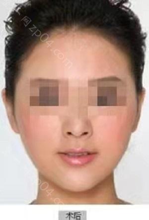 青岛壹美整形是正规医院吗？内含价格表及案例分析