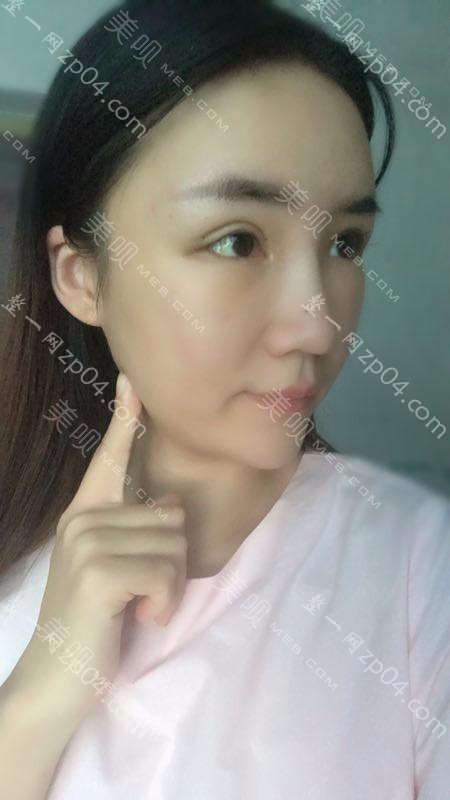 大连玻尿酸医院哪家好,排名前10推荐_附玻尿酸价格表