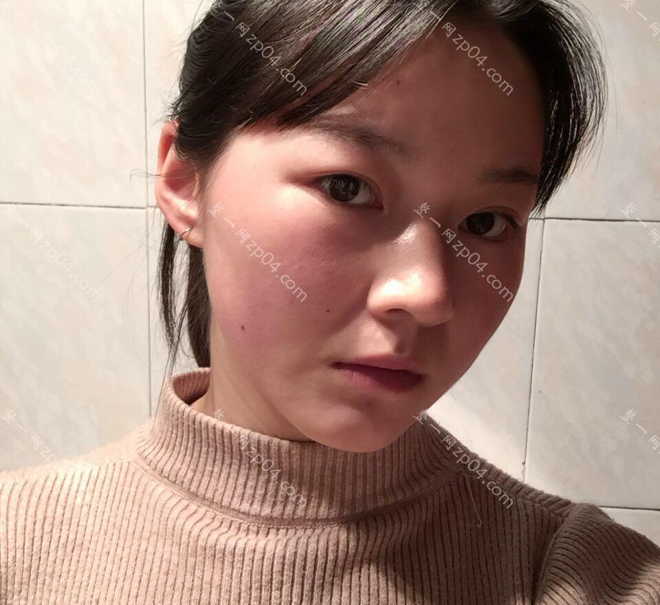 上海鼻部硅胶假体取出医院哪家好,排名前10推荐_正规鼻部硅胶假体取出医院