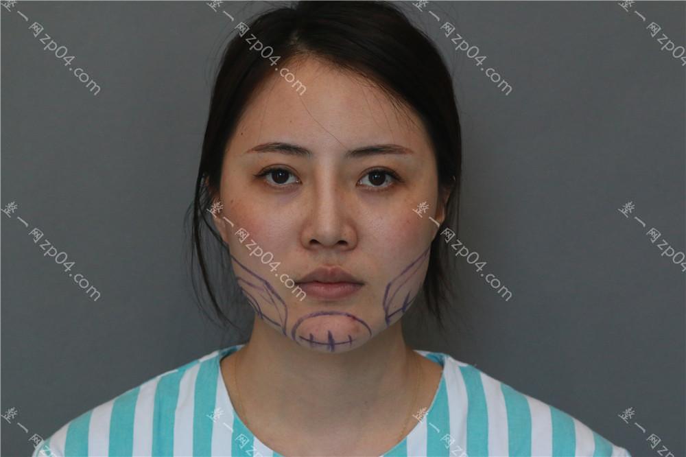 Ϻǲ轺ȡҽԺļҺ,ǰ10Ƽ_ǲ轺ȡҽԺ