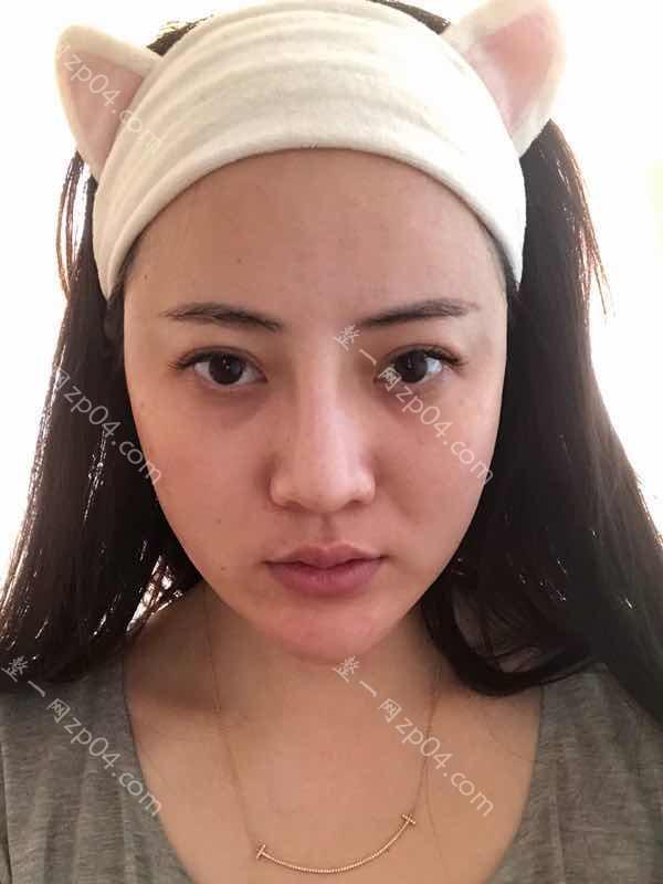 上海鼻部硅胶假体取出医院哪家好,排名前10推荐_正规鼻部硅胶假体取出医院