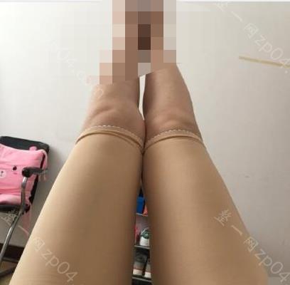 北京艺美医疗美容专家综合实力如何？做大腿吸脂后的效果好不好呢