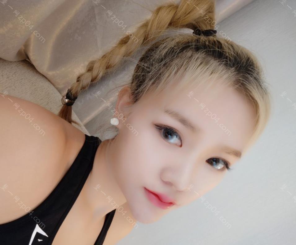 北京驭美客怎么样？做面部填充的技术如何呢？附上案例图
