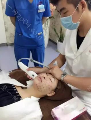 北京面部提升多少钱？做手术后的实际效果好吗