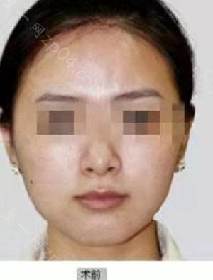 青岛壹美整形是正规医院吗？内含价格表及案例分析