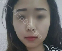 眉形不对毁所有纹眉失败案例，选对眉形的重要性！