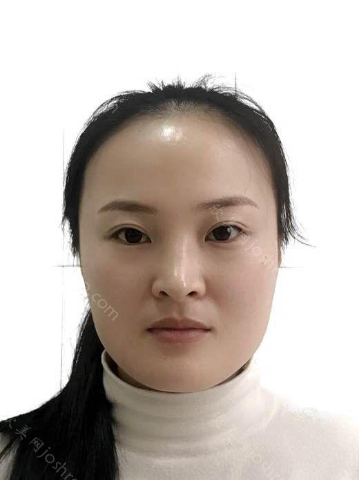 王惠婷