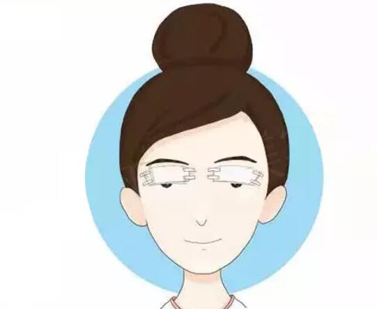 绍兴市胎记激光治疗哪里整形医院好(上虞艺美医疗美容门诊部口碑火了)