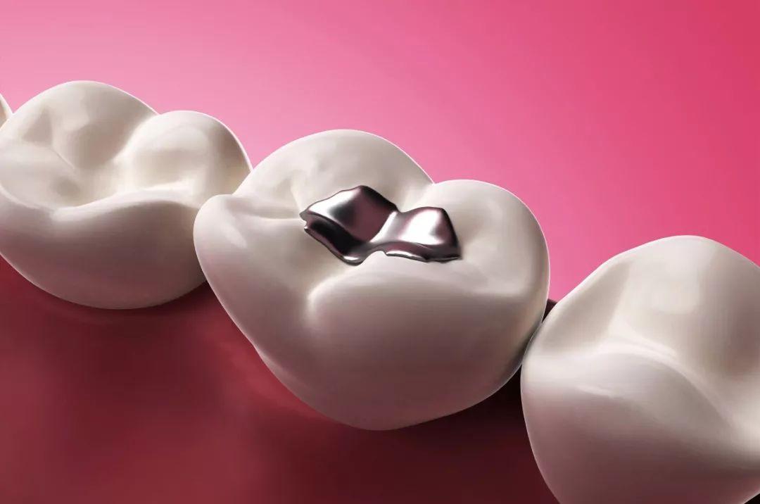 牙科专家：六成以上牙齿正畸需拔牙