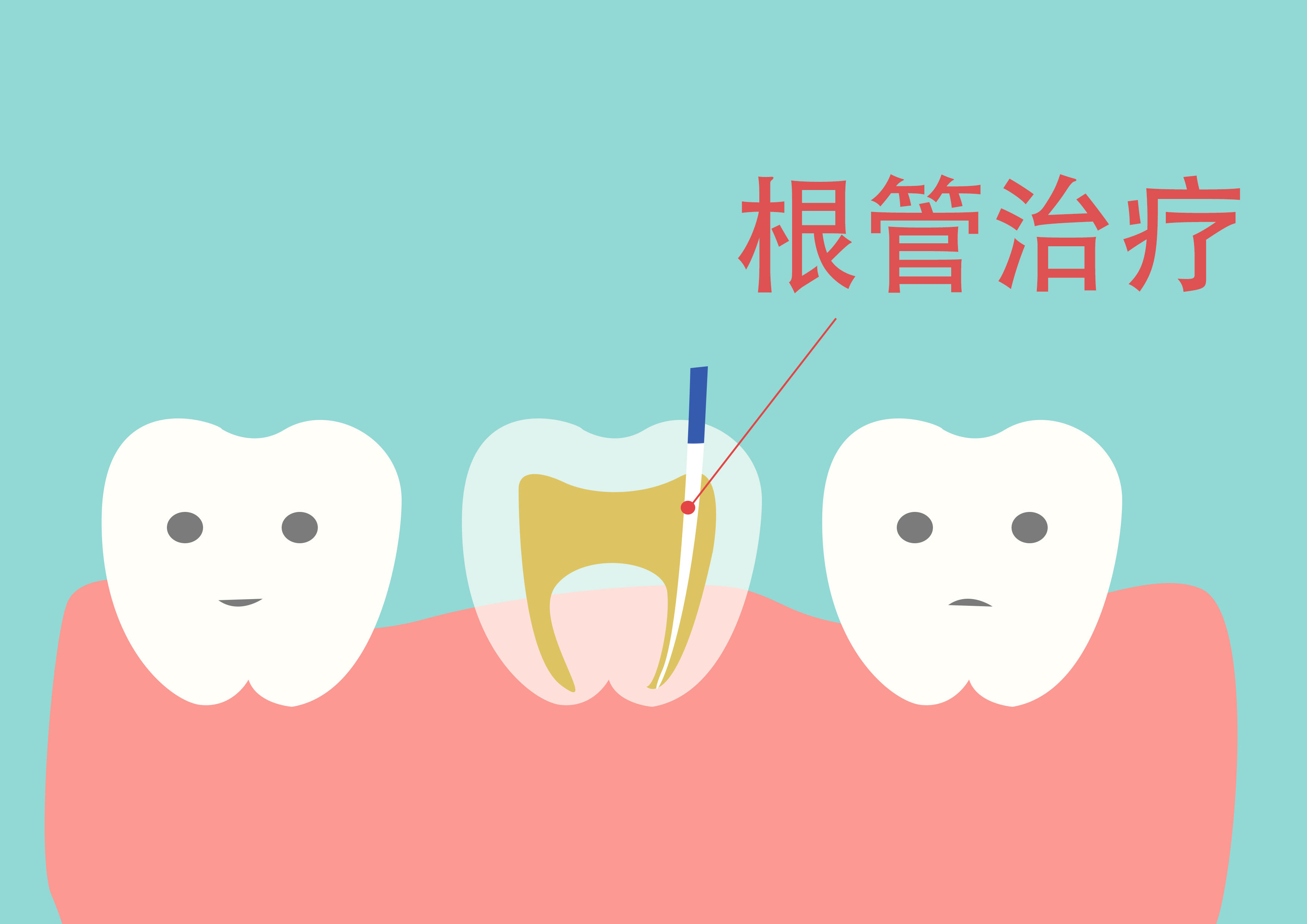 牙周炎发病有哪些症状表现?