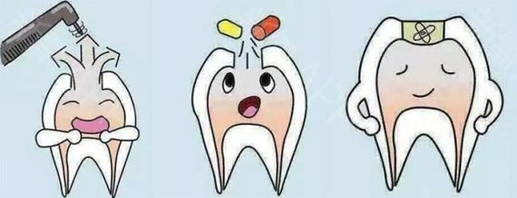 根管治疗牙髓炎的优势