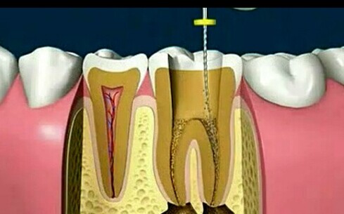 日常治疗牙周炎的六大偏方