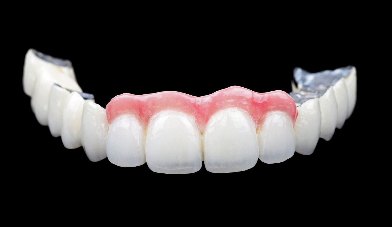 难缠的氟斑牙应该如何预防？