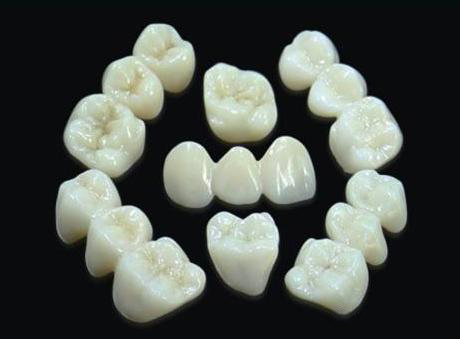 上海全瓷牙修复牙齿具有哪些优势