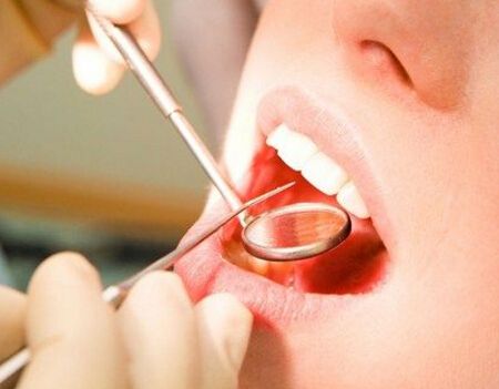 洗牙的适应症和禁忌症有哪些