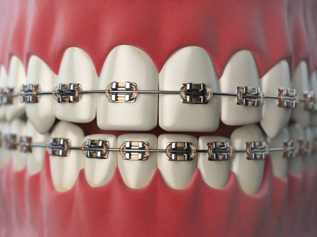 牙齿地包天有哪些危害？造成的6大危害不可忽视