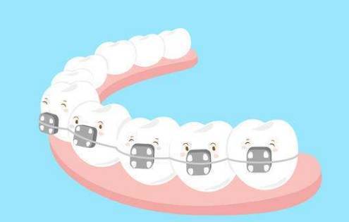 牙齿矫正术后护理措施