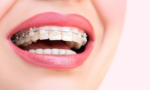 牙科医院谈固定义齿的优缺点
