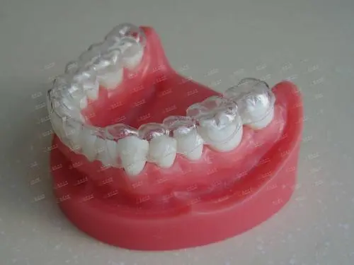 牙齿整形一般多少钱